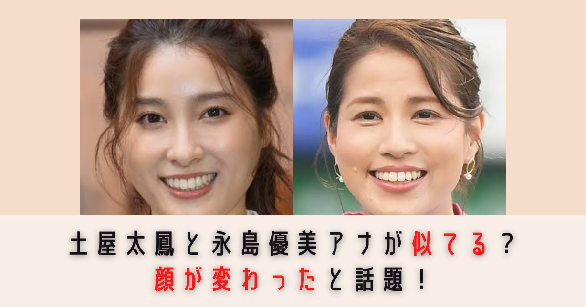 【画像比較】土屋太鳳と永島優美アナが似てる？顔が変わったと話題！